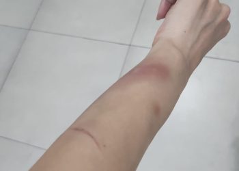 Diduga Tidak Profesional, Polsek Medan Area Disorot