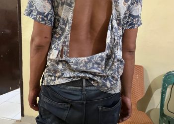 Dikeroyok Saat Mau Beli Nasi Goreng, Warga Langkat Lapor ke Polsek Selesai